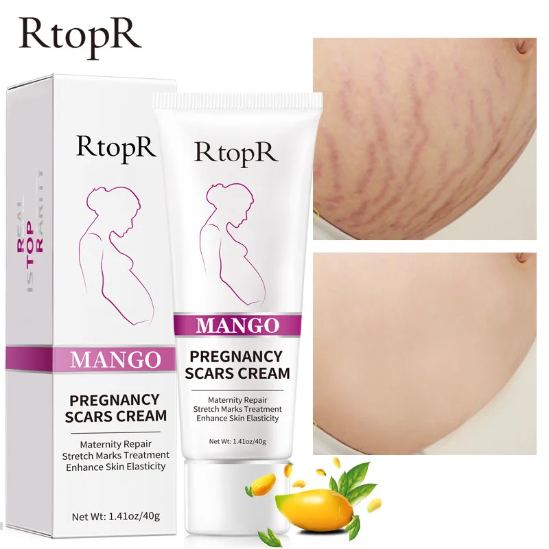 

RtopR Remove Pregnancy Scars Acne Cream Stretch Marks Treatment Maternity Repair Anti-Aging Anti Winkles Firming Body Creams