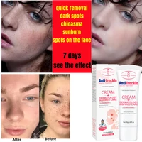 whitening freckle cream remove dark spots melanin melasma brighten face cream pigmentation anti aging skin care cosmetics 20ml