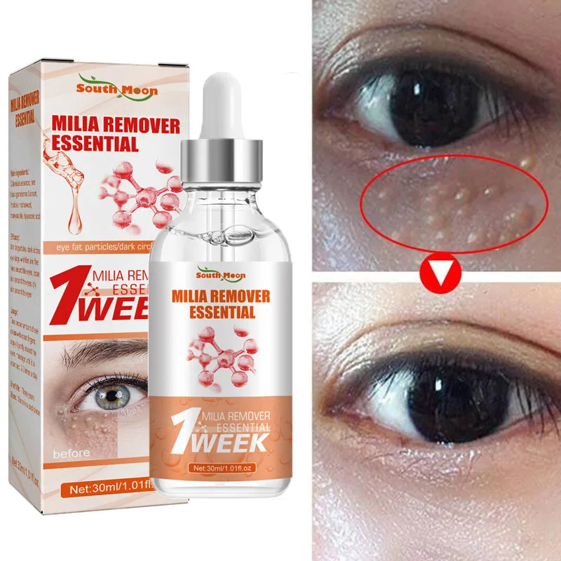 

7 Days Eyes Fat Granules Removal Serum Remove Dark Circles Eye Bag Fade Fine Lines Anti-Puffiness Firming Moisturizing Eye Care