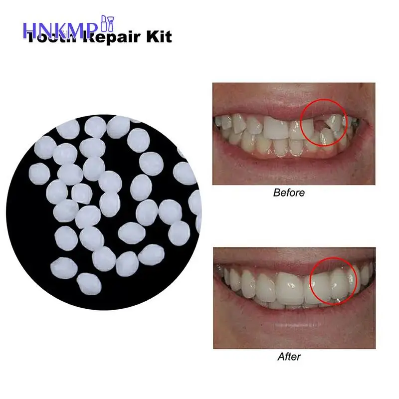 

30ml Solid Glue Denture Adhesive Set Bottled Denture Solid Tooth Gel Temporary Tooth Repair Kit Teeth And Gaps False Teeth