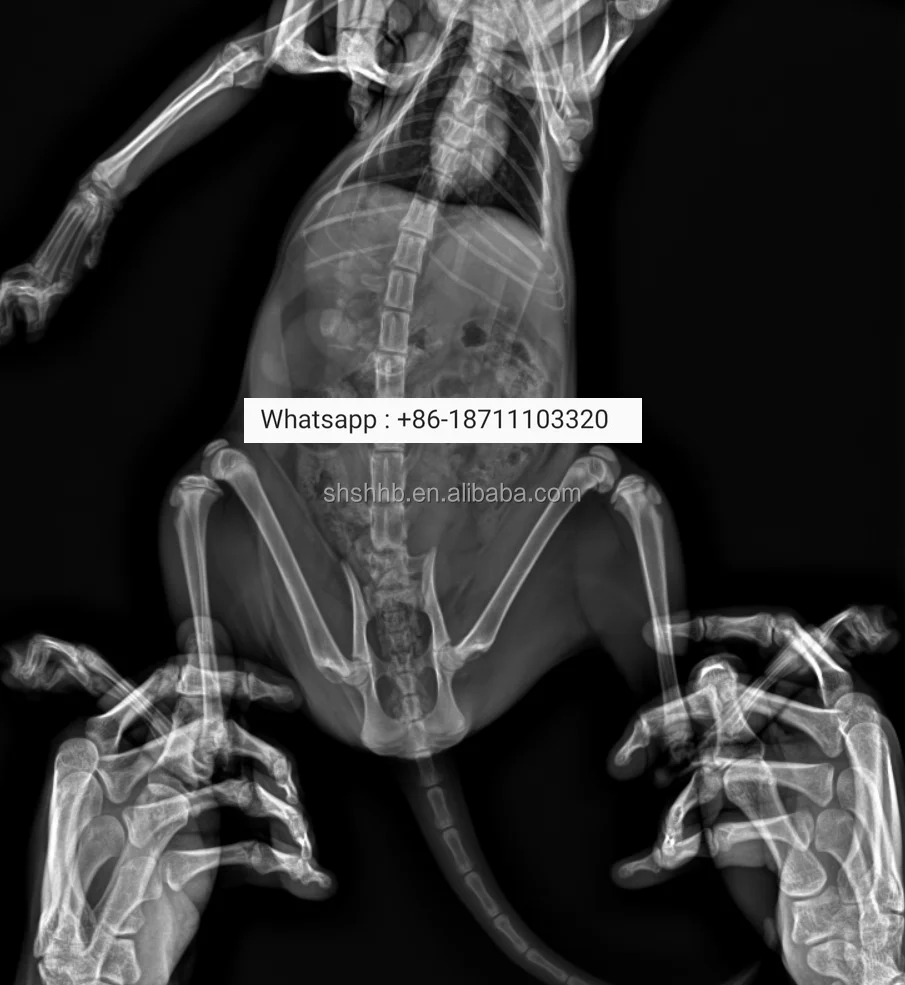 Рисунок 4 - Детектор рентгеновских снимков