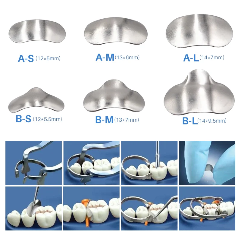 100 шт./компл. держатель колец для стоматологических матриц секционные контурные