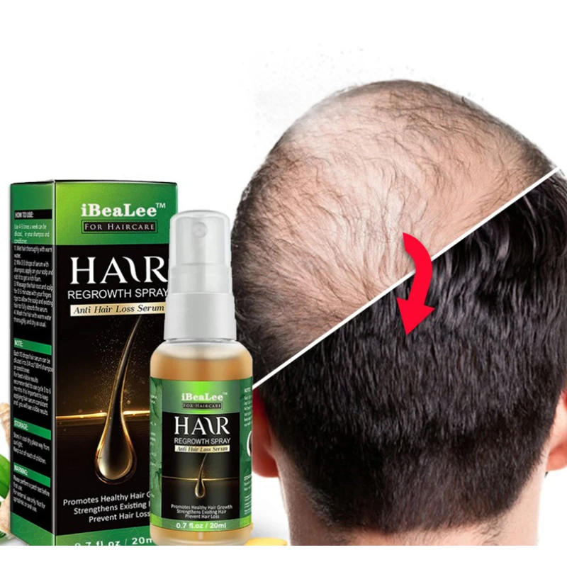 

Товары для роста волос, Имбирная эссенция, Ранняя сыворотка, масло для роста бороды, выпадение волос, уход за кожей головы, лечение кожи голо...