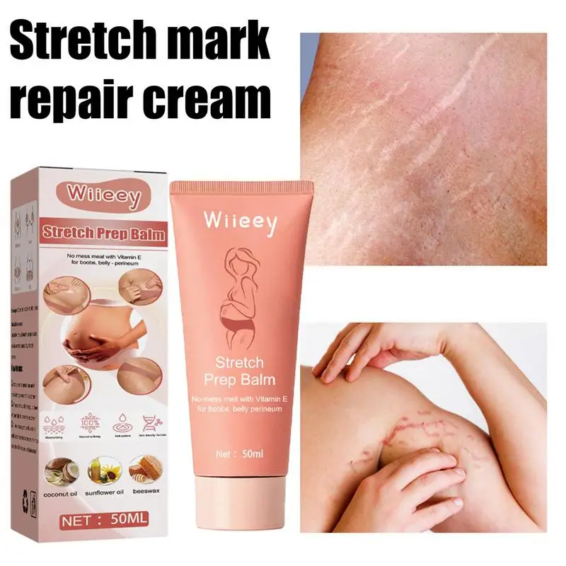 

Stretch Mark Remover Cream With Coconut Sunflower Oil 50ml Natural Beeswax Maternity Skin Care Freckl Spot Repair Massage Lotion