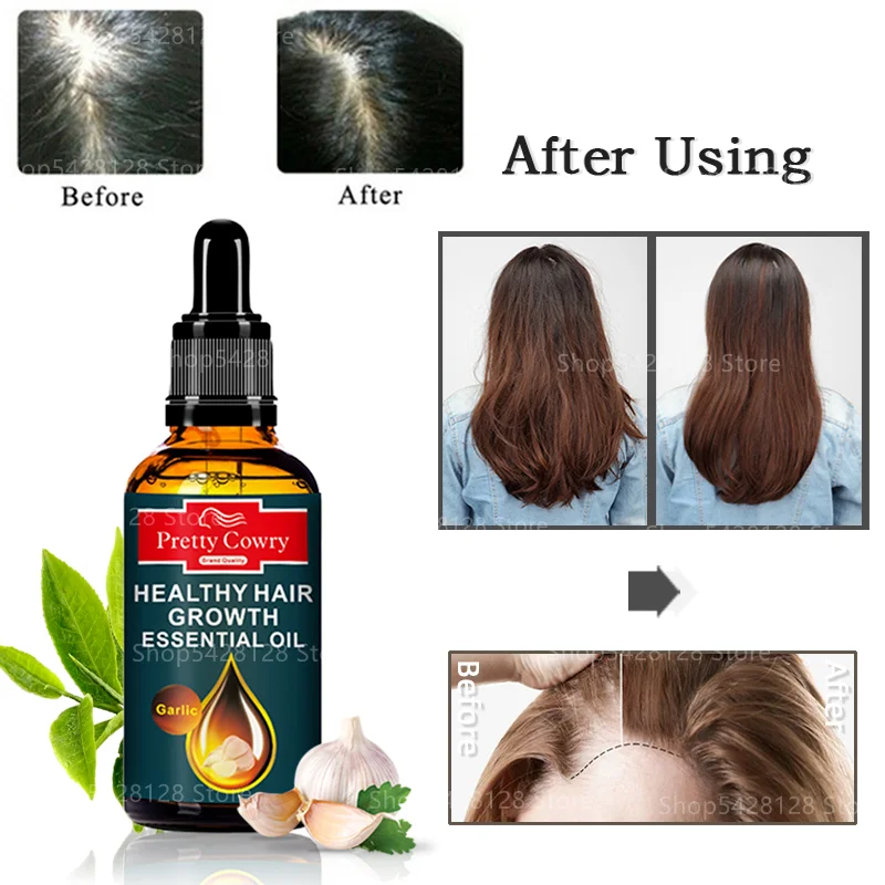 

Hair Growth Conditioner Hair Essential Oil Anti-falling Nourishing Scalp Hair Growth Liquid Ginger, Ginseng, Garlic 50ml