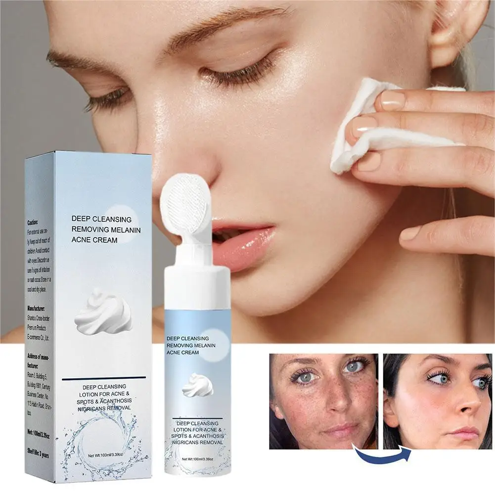 

Deep Cleansing Lotion Anti Acne Cleanser Whitening Control Pimple Blackhead Wash Smooth Foam Removal Spots Oil Face T7Q0