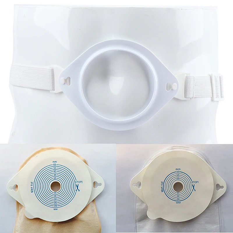 Набор регулируемых ремней для фиксации остомии