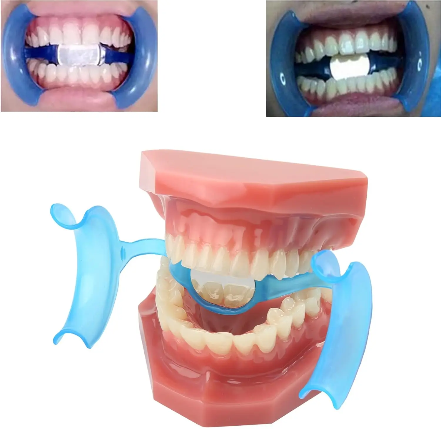 Стоматологический ретрактор для щек открывалка рта M-образная форма