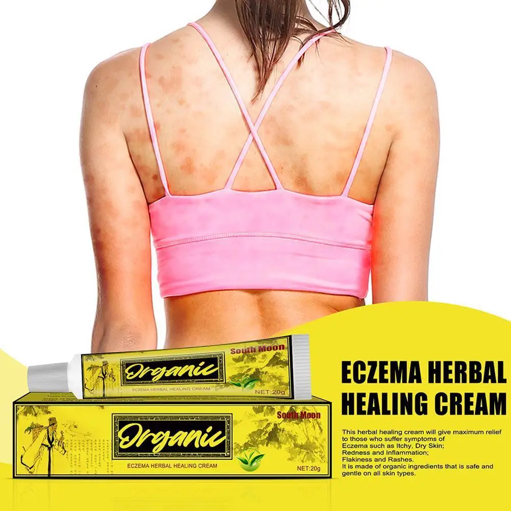 

Крем для снятия псориаза, дерматита, экземы