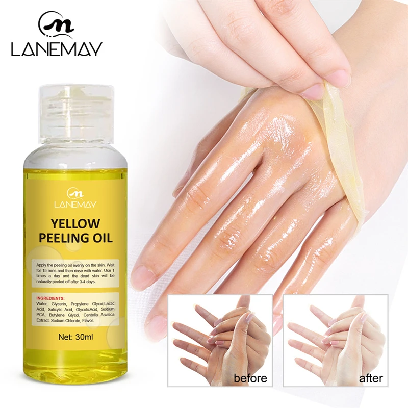 Yellow Peeling Oil Dark Skin Bleaching Remove Arm Knee Legs Melanin Body Lightening Mask Exfoliating Dead Skin Whitening Serum