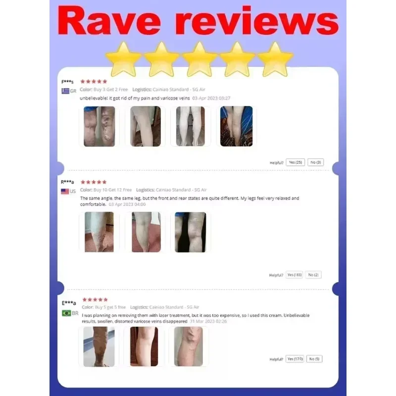 Кровяные сосуды Spider эффективное облегчение варикозного расширения вен