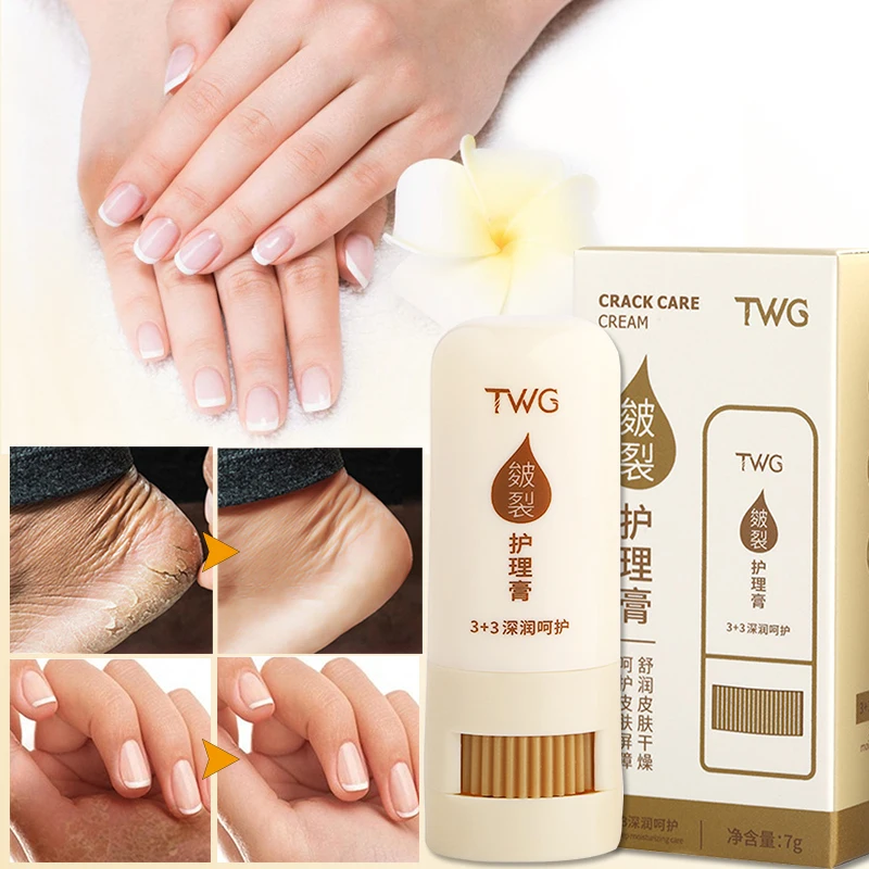 

Hand Feet Anti Crack Moisturizing Balm Removal Dead Skin Anti-Drying Exfoliating Whitening Nourishing Natural Foot Care Cream