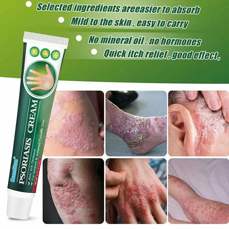 20g Skin Cream Anti-itching Ointment Skin Effective Rash Cream Relieve Itchy Skin Moss Cream Herbal Extract External Ointment