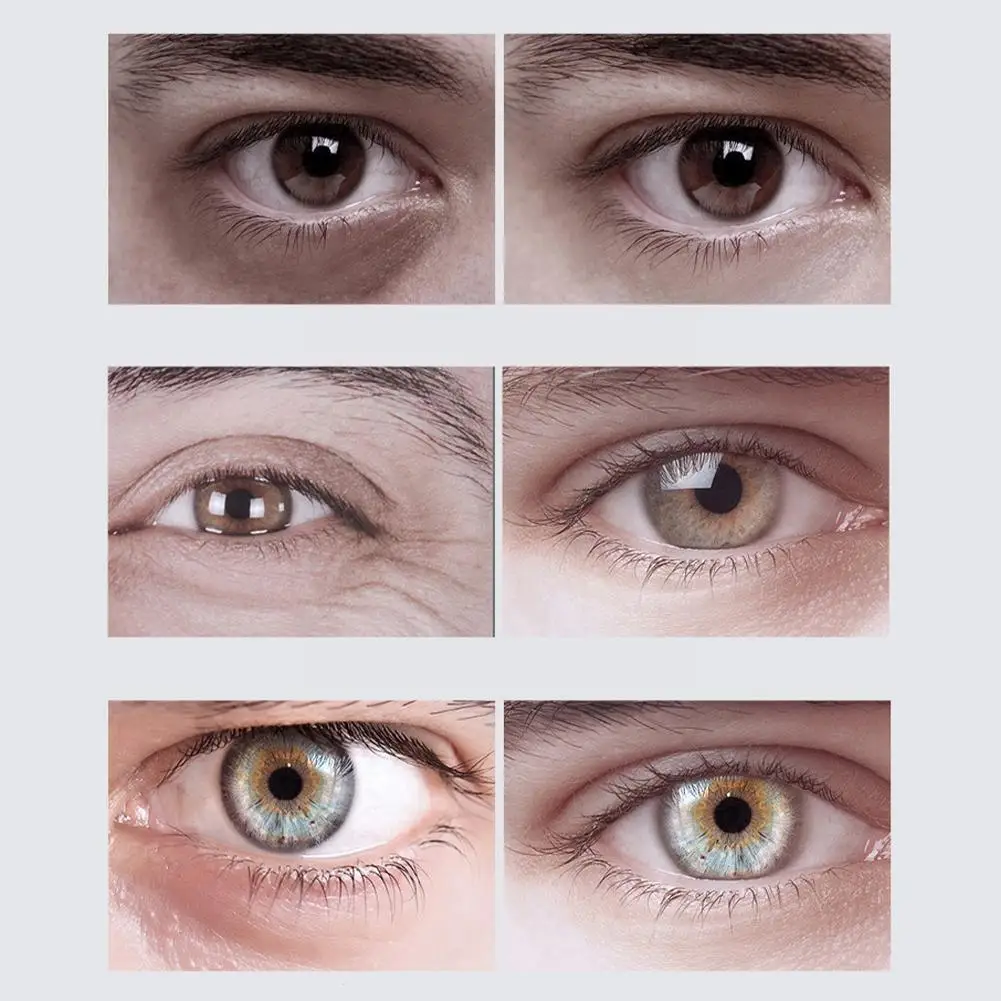 

20g Eye Cream Anti Anti-aging Remover Dark Circles Serum Cream Care Eye Eye Massage Men Beauty Eye Swelling E9a1