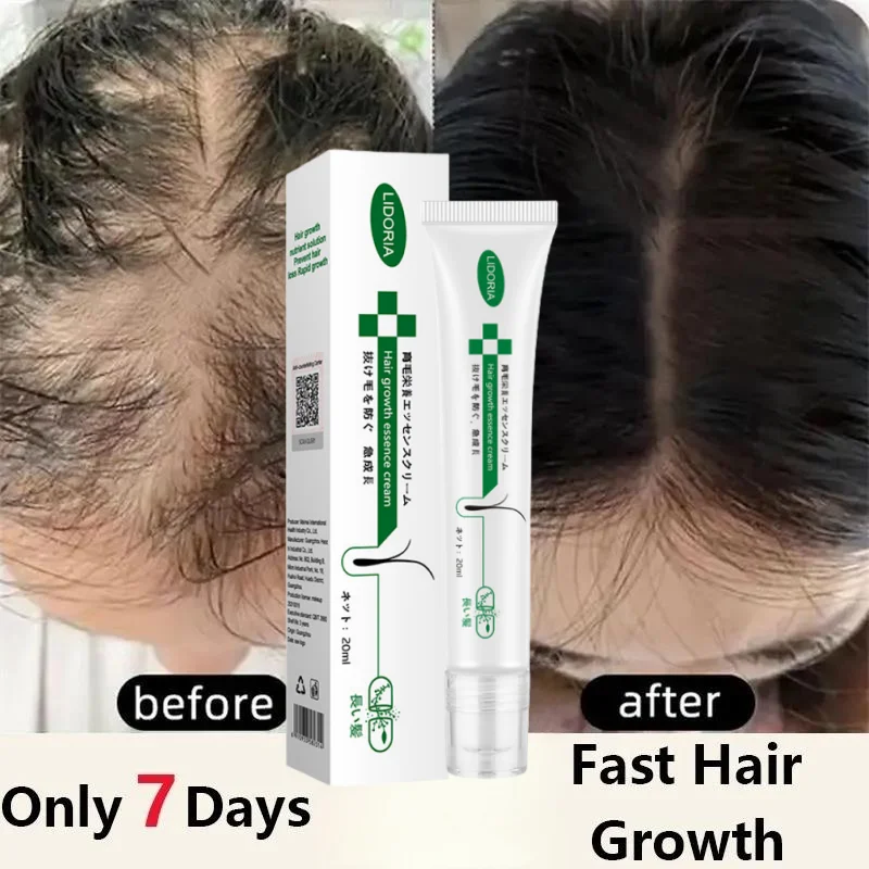 

Fast Hair Regrowth Oil Anti Preventing Hair Thinning Effective Baldness Repair Hereditary Seborrheic Hair Loss Hair Care Serum
