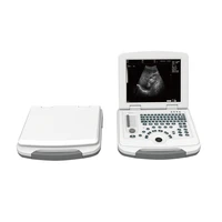 high cost performance portable laptop ultrasound scanner bw machine with convex probe