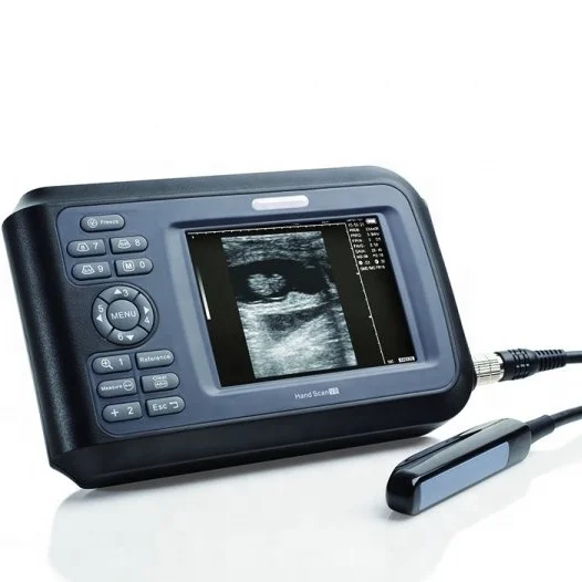 

Digital PalmSmart Ultrasonic Scanner with Convex Probe Ultrasonic Scanner Veterinary