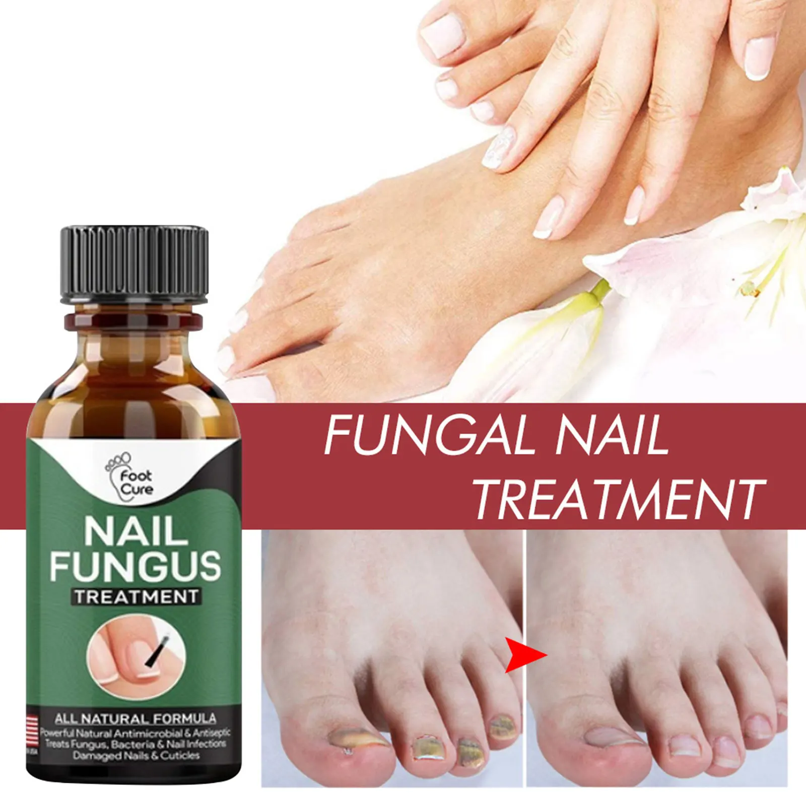 

30ml Nail Repair Serum Essences Fungal Care Treatments Foot Nail Fungus Removal Gel Anti-infective Paronychia Onychomycosis