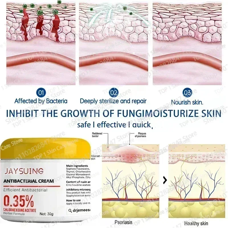 Увлажняющий крем от псориаза естественный ремонт эффективно антибактериальный