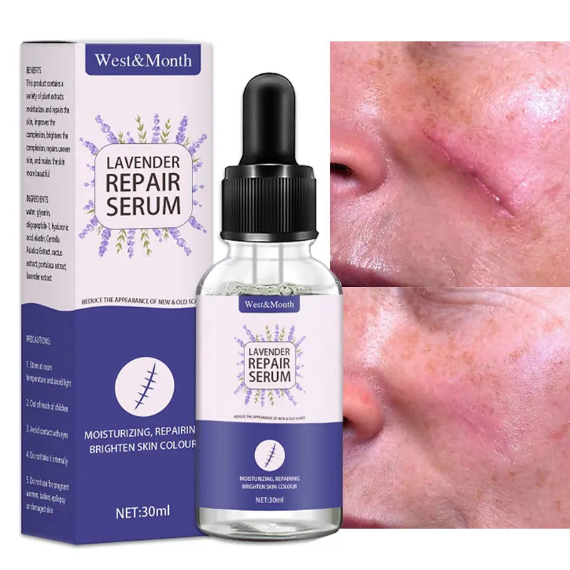 Scar Repairing Serum Stretch Marks Removal Liquid Lighten Blemish Acne Pox Spots Surgical Burn Scars Remover Whitening Skin Care