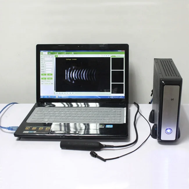

Medical A Scan B Scan Ophthalmic A/B scanne ultrasound ophthalmology