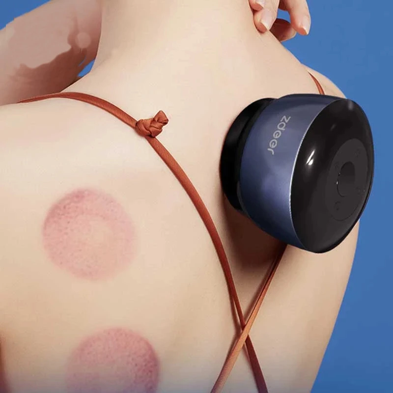 Novo ponto de esquerda portátil inteligente cupping massageador ventosas a vácuo ímã terapia guasha raspagem massagem aquecimento