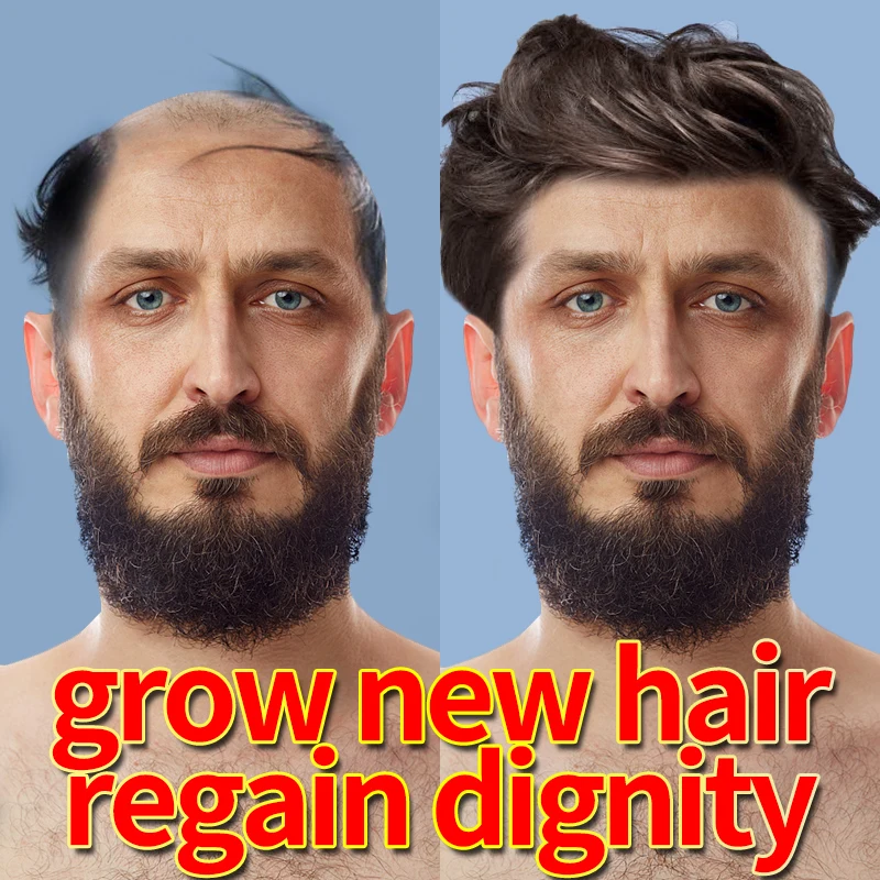 Эффективное восстановление волос Натуральный Тоник против выпадения с эфирным