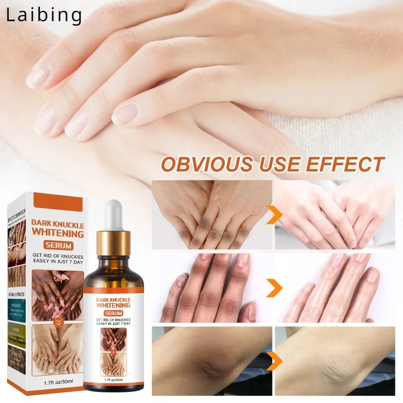 Блестящая эссенция для декорирования суставов пальцев локтей коленей уменьшает