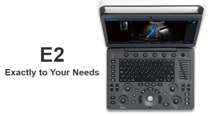 Рисунок 6 - Ультразвуковая портативная ветеринарная