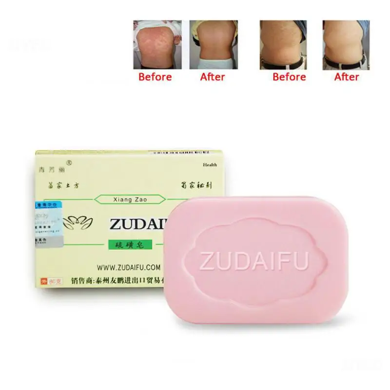 

Zudaifu Sulfur Sulphur Soap Skin Repair Acne Psoriasis Seborrhea Eczema Anti Fungus Bath Whitening Shampoo Psoriasis Cream