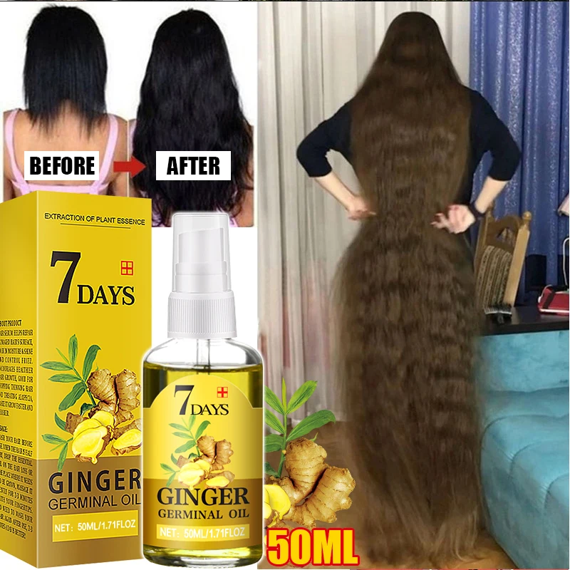 

Fast Hair Growth Men Women Ginger Growth Hair Oil Treatment Anti Hair Loss Scalp Treatment Serum Products Beauty Health