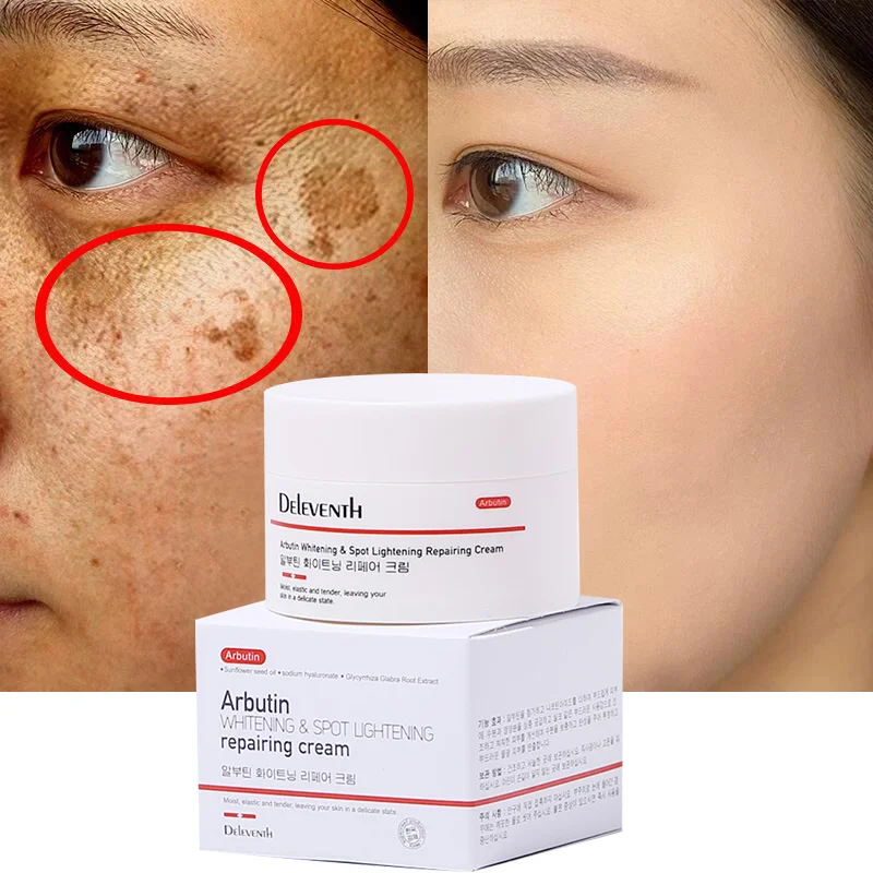 

Arbutin Whitening Freckle Face Cream Remove Melasma Fade Dark Spots Melanin Moisturizing Brighten Skin Care Products Beauty 30ml