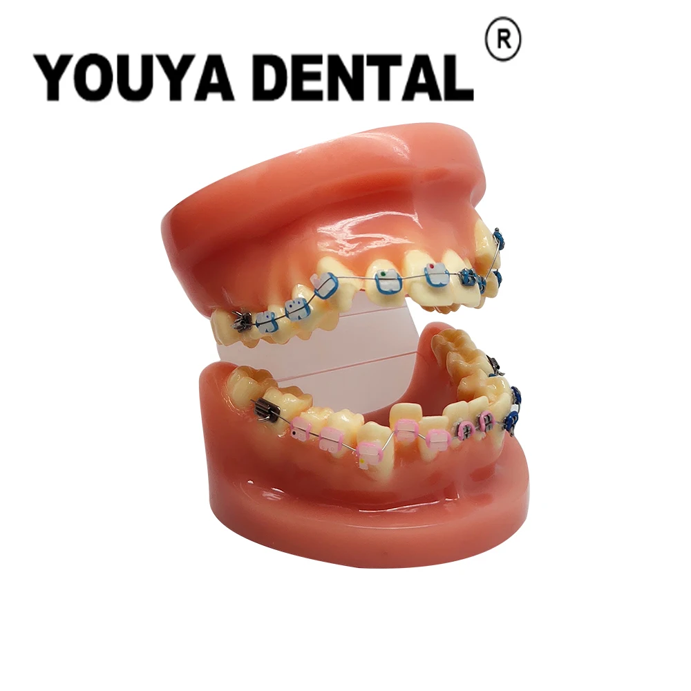 

Dental Model Wrong Jaw Half Metal Half Ceramic Orthodontic Model For Dentist Student Studying Teaching Demonstration Tool
