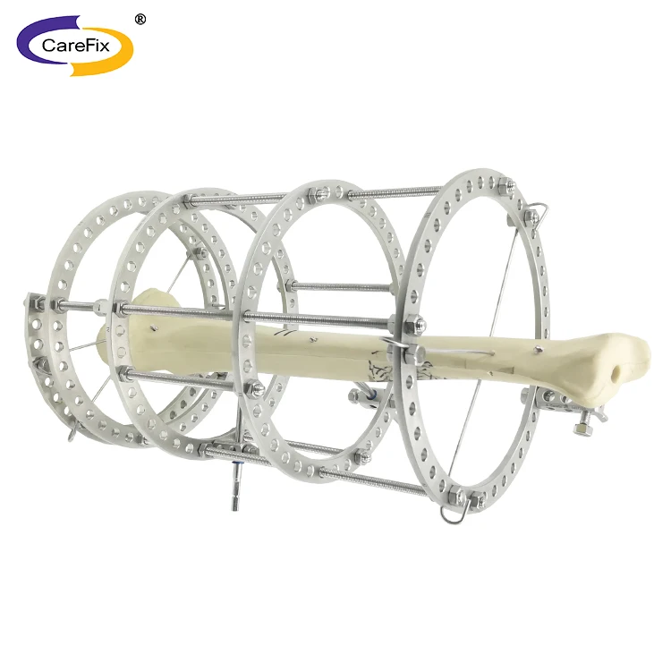 

Orthopedic surgery fixation equipment and equipment can be customized at super preferential prices