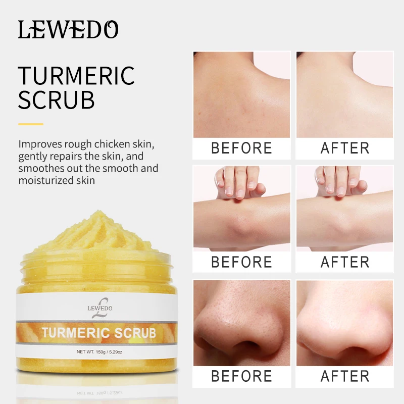 

Lewedo Natural Turmeric Face Body Scrub Effectively Exfoliates Cleans Pores 150g Improves Acneprone Seaweed Salt Scrub Skin Care