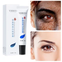 powerful whitening freckle cream remove melasma acne spot pigment melanin dark spots pigmentation moisturizing gel skin care
