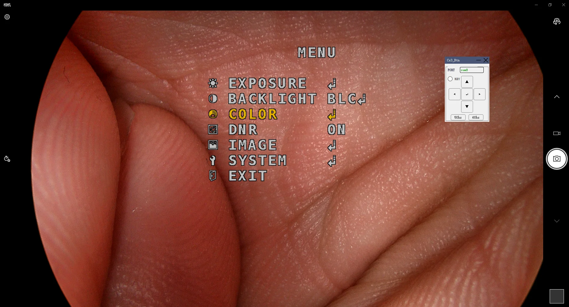 Full HD CMOS Медицинская Портативная USB-эндоскопическая камера для ЛОР-назального