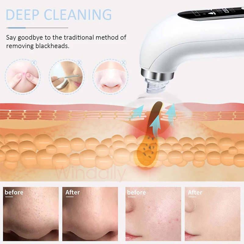 2022 Blackhead Remover Pore Vacuum Cleaner Electric Micro Small Bubble Facial Cleasing Machine USB Rechargeable Beauty Device |