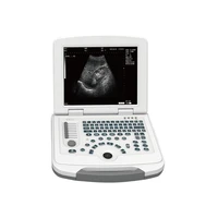 factory price laptop medical ultrasound instruments ultrasonic scanner with convex probe