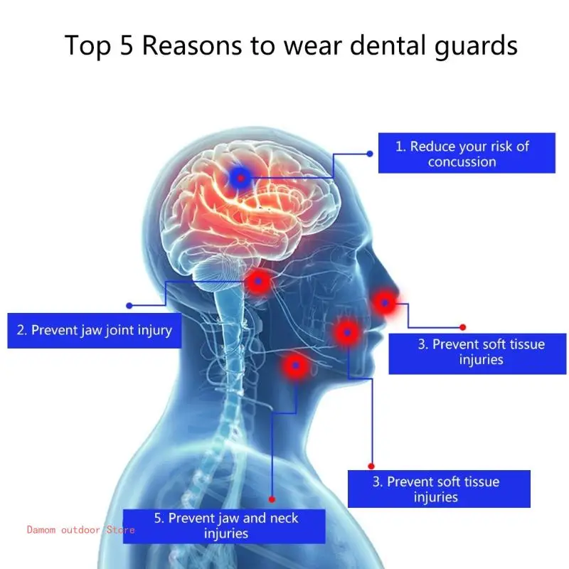 Спортивная каппа двухсторонняя защита для зубов спортивная