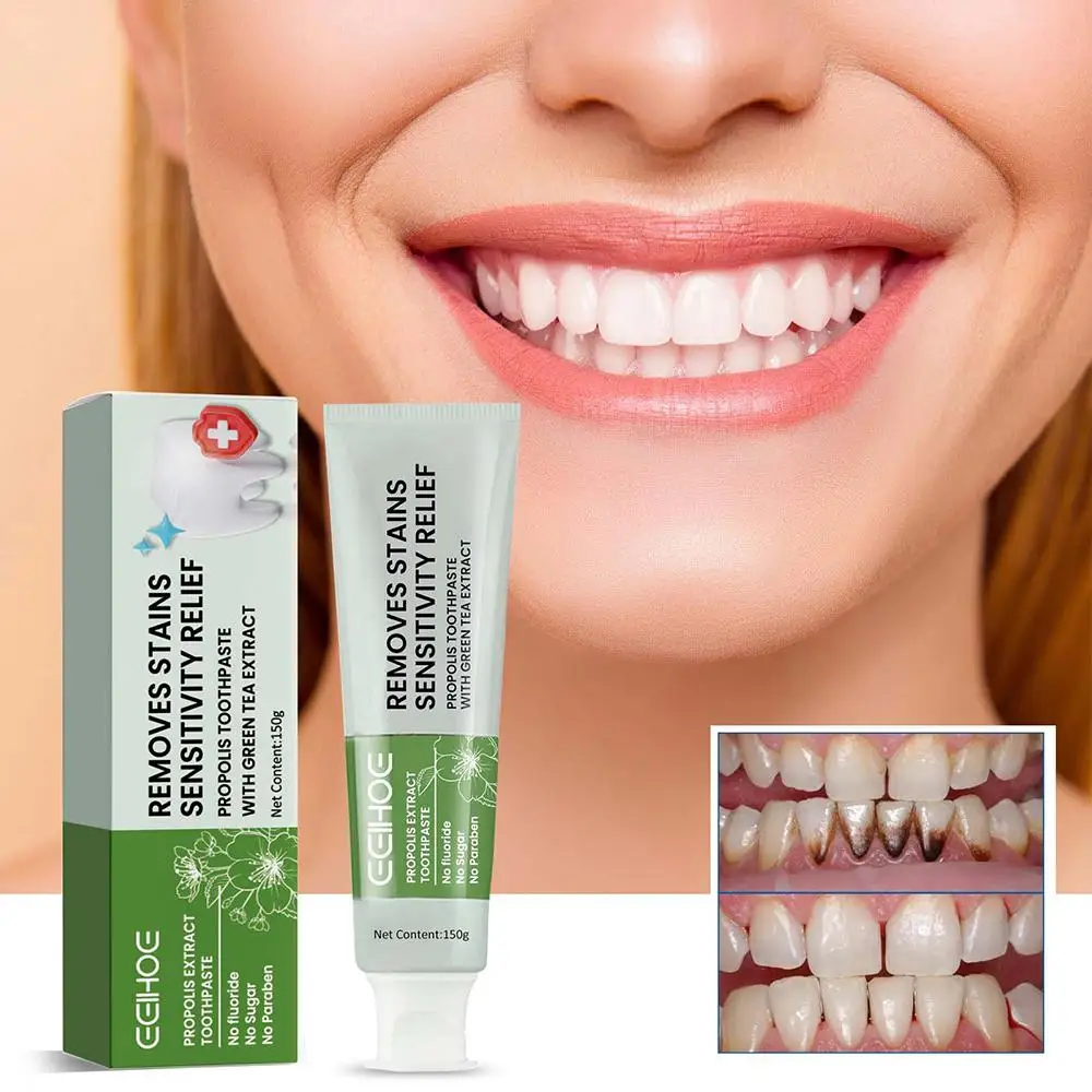 

Stain Removal Whitening Toothpaste Propolis Anti-plaque Care Cleaning Health Fresh Oral 150g Teeth Dental Gum Breath Whiten U5P2