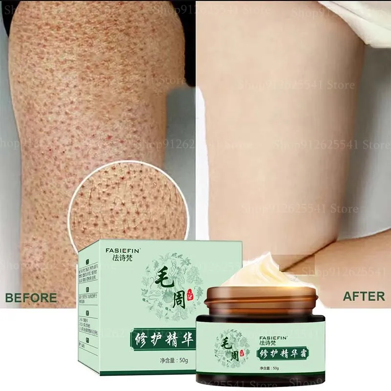 50 г крем для волосяного фолликула и кератоза восстанавливает кожу