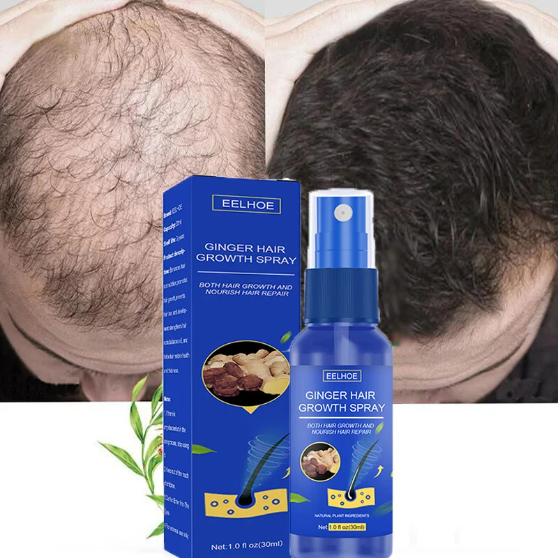 

Ginger Hair Growth Spray Fast Grow Anti Hair Loss Essential Oils Prevent Baldness Thinning Scalp Treatment Nourish Repair Care