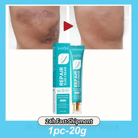 PWYUMAN Крем для удаления шрамов