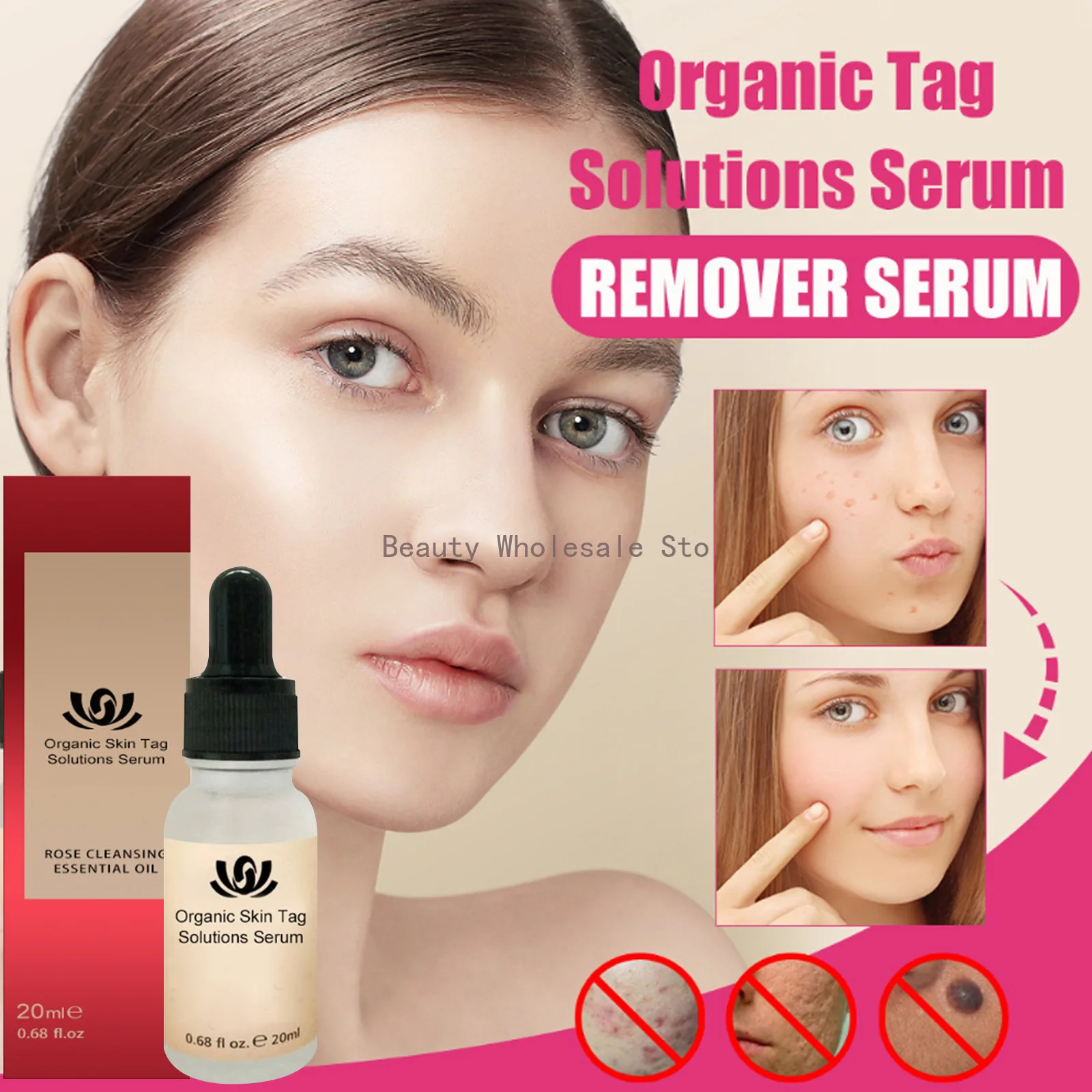 

Traceless Mole Repair Liquid Warts Corn Tags Black Moles Removal Cream Herbal Face Care Liquid Dark Spot Remover Serum 20ml