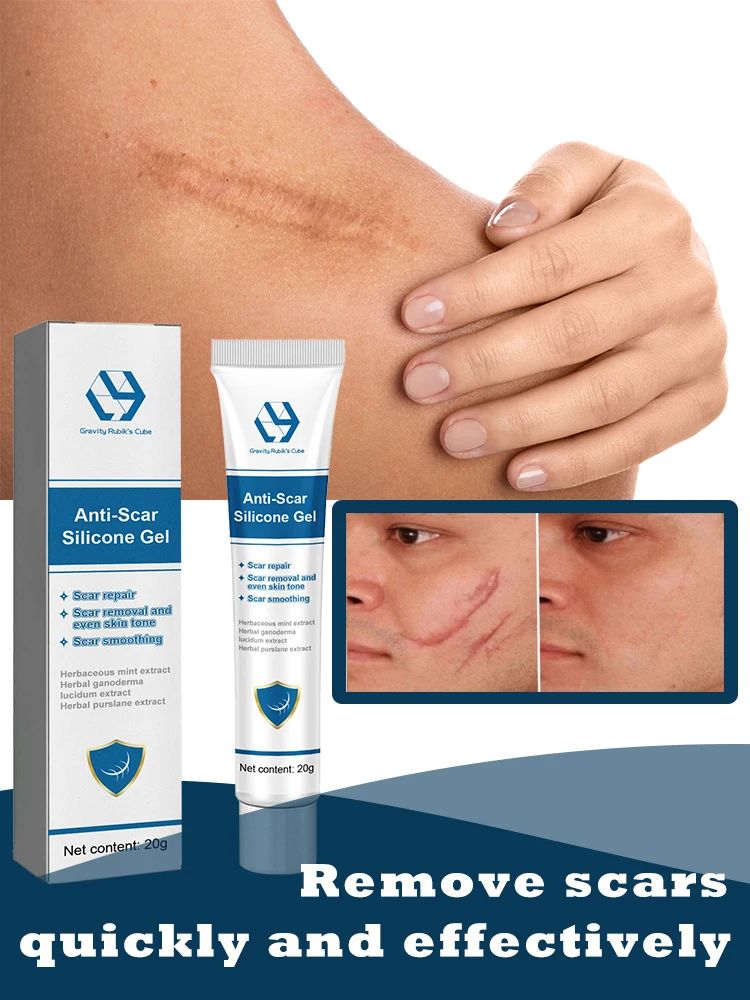 Келоидный крем