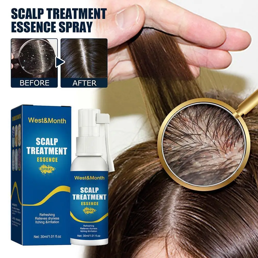 

30ml Scalp Treatment Essence Spray Cleansing Nourishing Anti Dandruff Itching Repair Prevent Hair Loss Smooth Hair Care for
