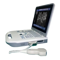 cheapest and affordable full digital black and white portable human and veterinary ultrasound scanner factory price