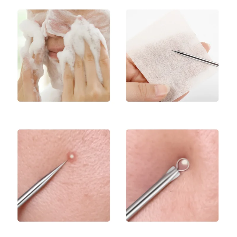 1/4 шт. инструменты для удаления чёрных точек на лице