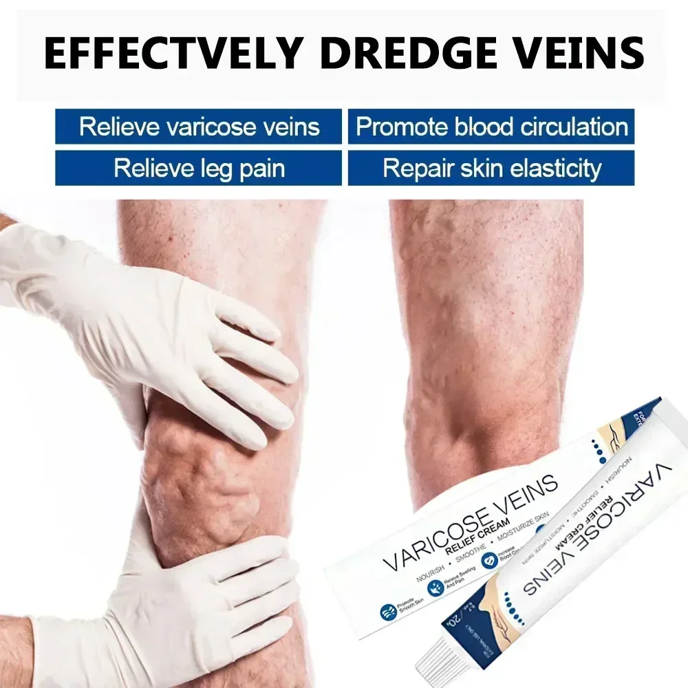 Крем-паук для удаления варикозного расширения вен и ангиита